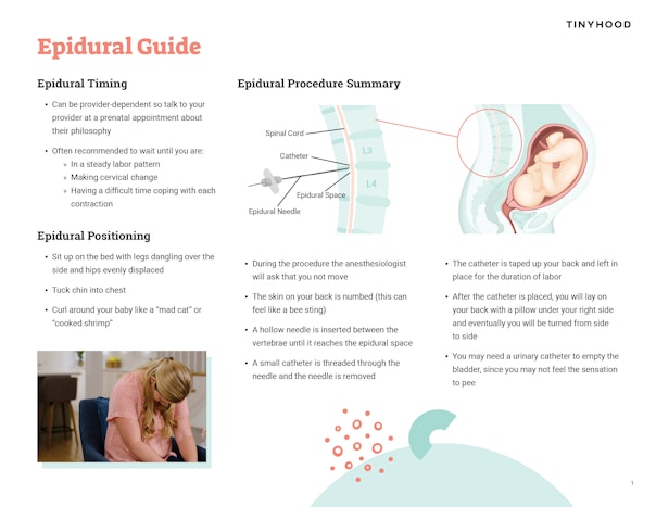 Epidural Guide Preview Image