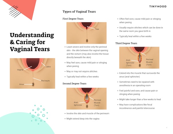 Understanding & Caring for Vaginal Tears Preview Image