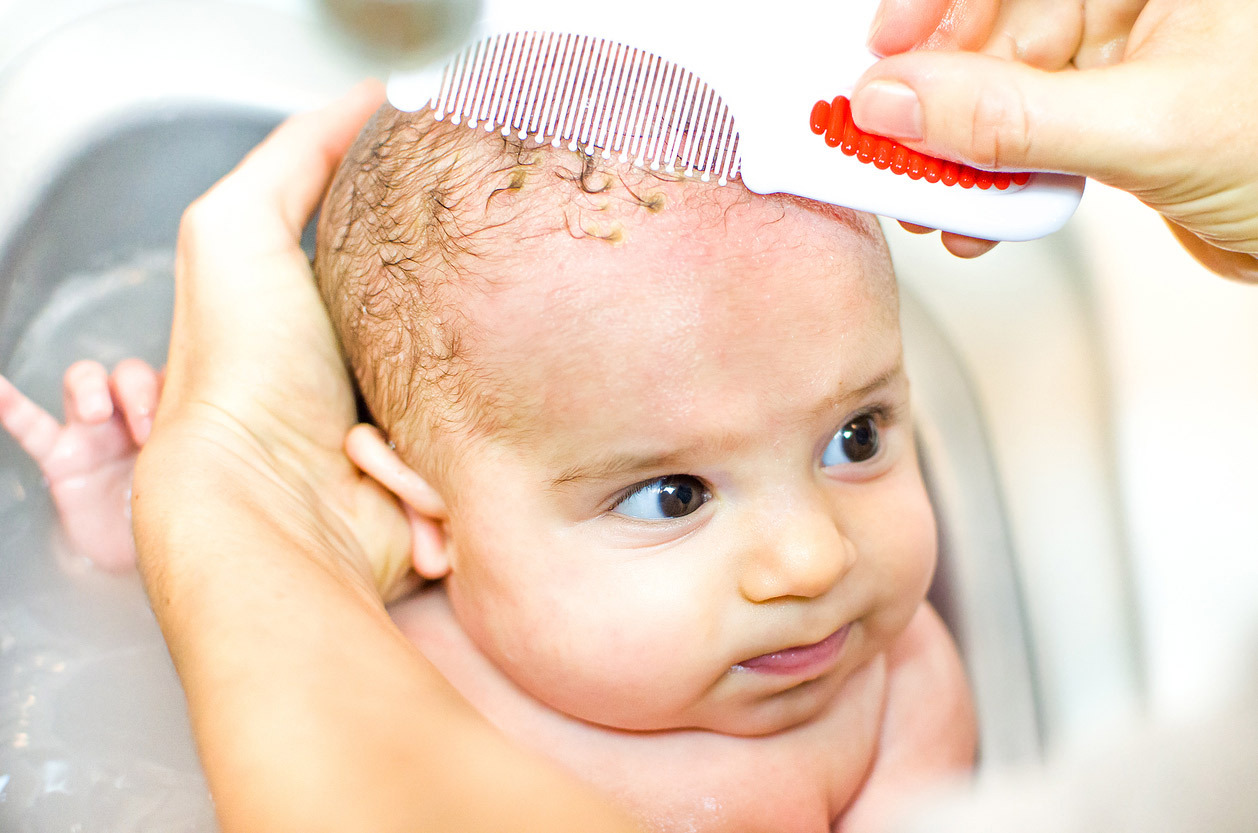 Parent holding baby in bath, baby looking off to the right, while parent combs through cradle cap on baby's head.